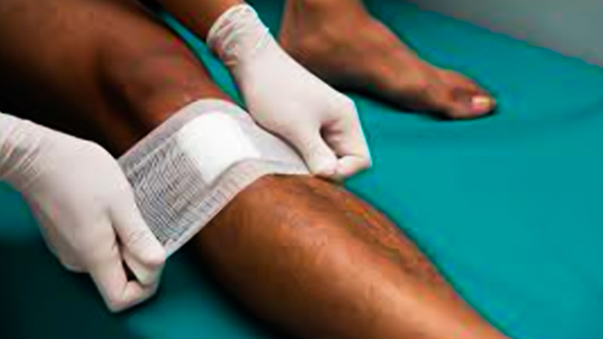 छोटी-मोटी चोट और कट लगने पर कैसे करें फर्स्ट एड | First Aid Tips To Manage A Cut At Home in Hindi First-Aid-Tips-To-Manage-A-Cut-At-Home-inside