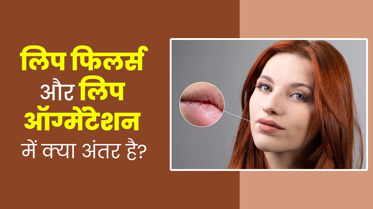 लिप फिलर्स और लिप ऑग्मेंटेशन में क्या अंतर है? डॉक्टर से जानें