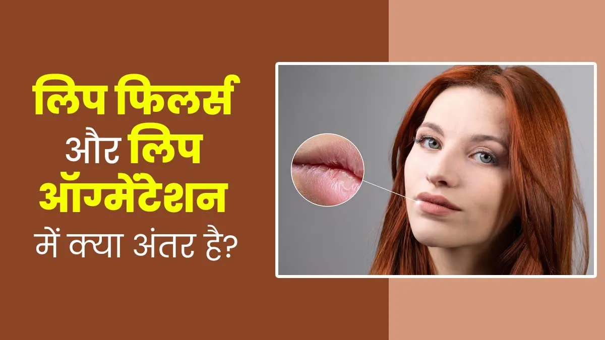 लिप फिलर्स और लिप ऑग्मेंटेशन में क्या अंतर है? डॉक्टर से जानें