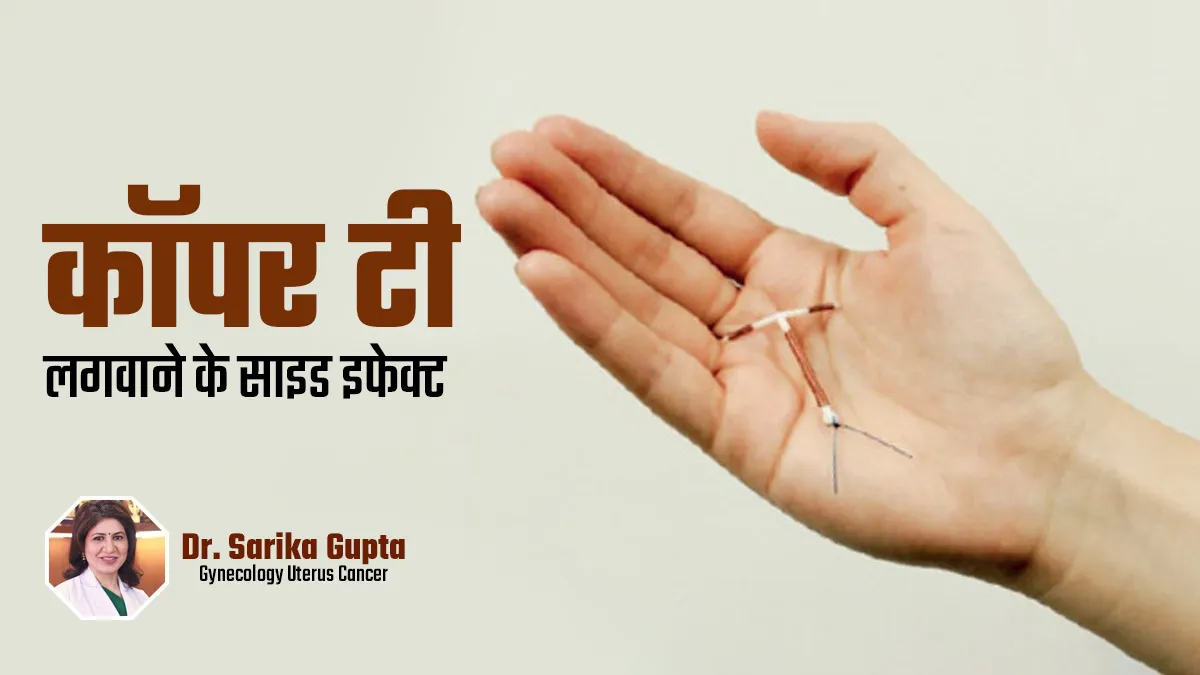 कॉपर-टी लगवाने के बाद हो सकते हैं ये 5 साइड इफेक्ट, हर महिला को जानना है जरूरी