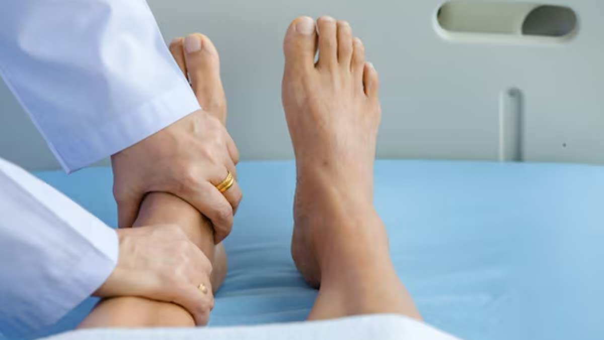 guillain-barre-syndrome