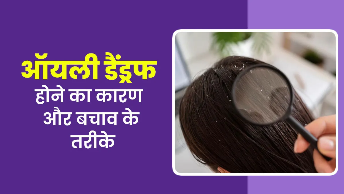 आप भी हैं ऑयली डैंड्रफ से परेशान, तो डॉक्टर से जानें कारण और बचाव के टिप्स