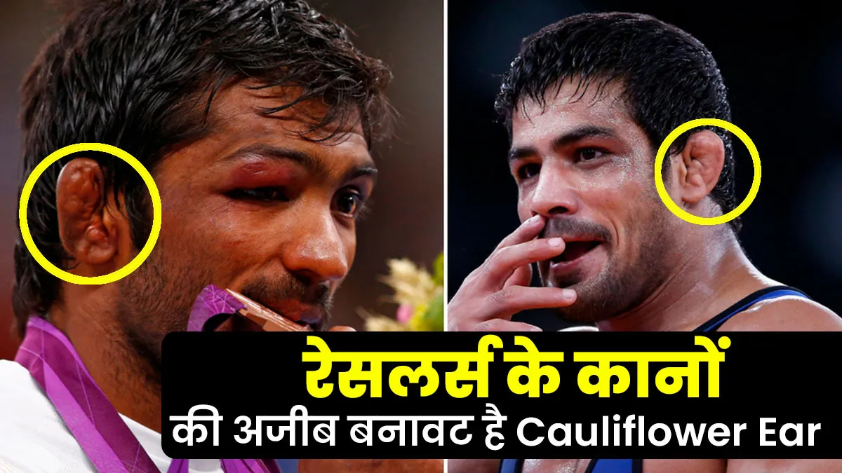 रेसलर्स के टेढ़े-मेढ़े और अजीब कान का कारण है Cauliflower Ear, डॉक्‍टर से जानें इसके लक्षण, कारण और इलाज