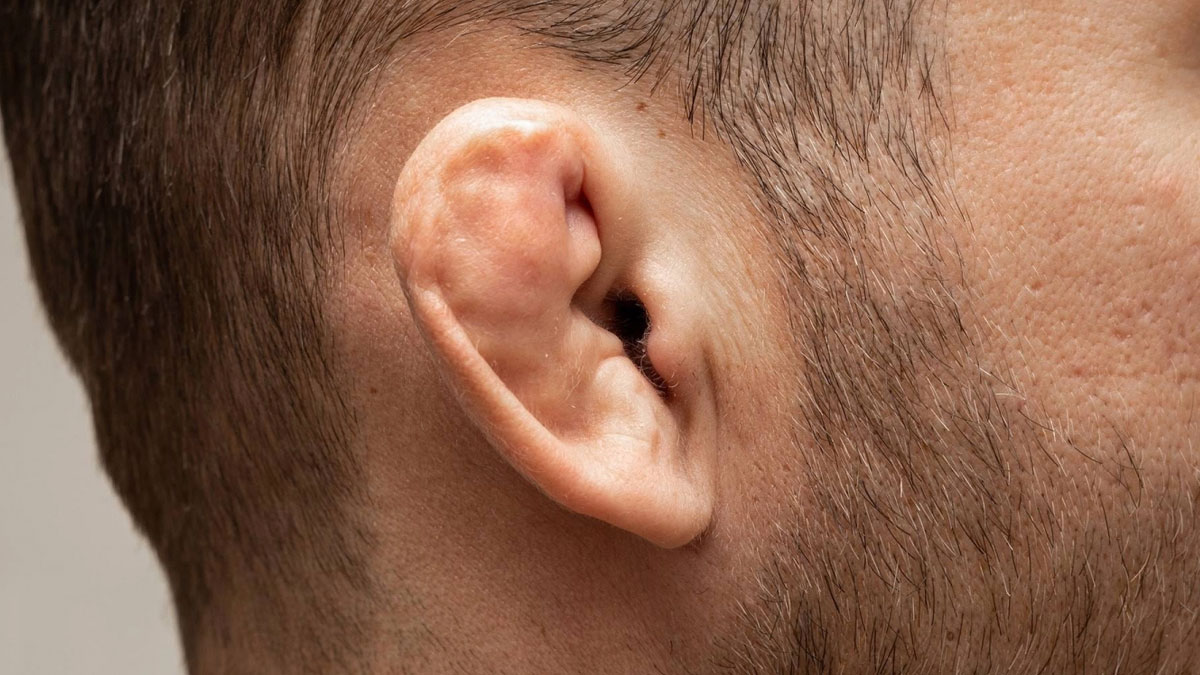 cauliflower-ear-symptoms