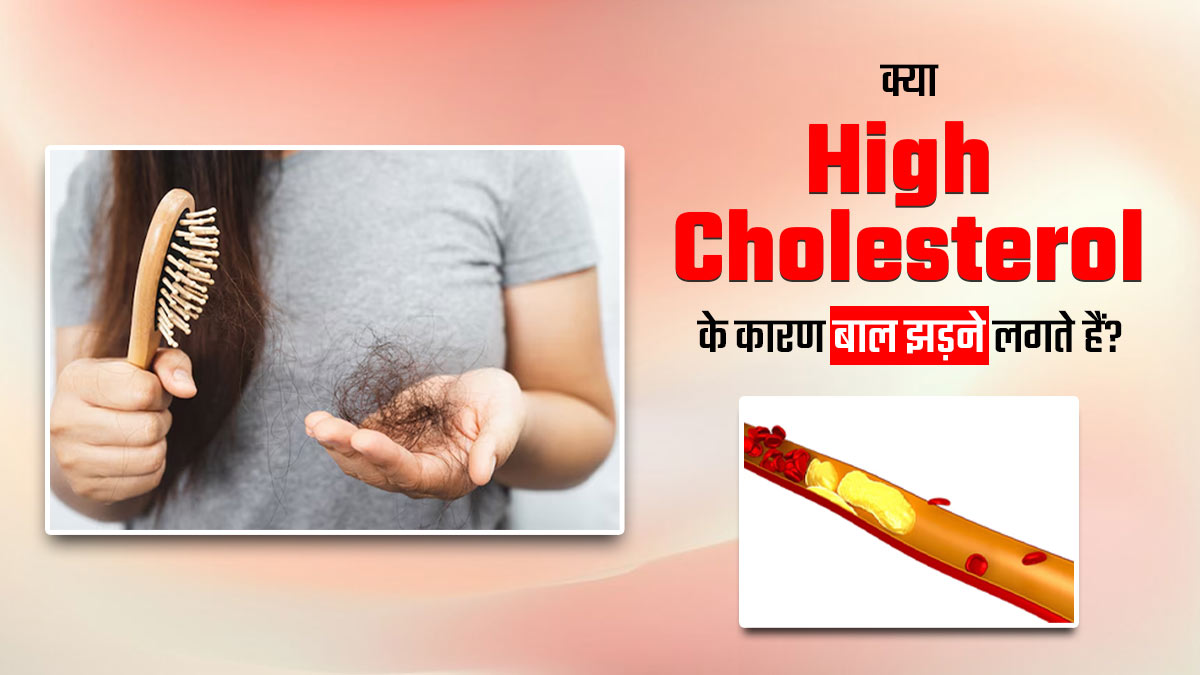क्या अचानक झड़ने लगे हैं बाल? कहीं हाई कोलेस्ट्रॉल तो नहीं कारण? जानें डॉक्टर से
