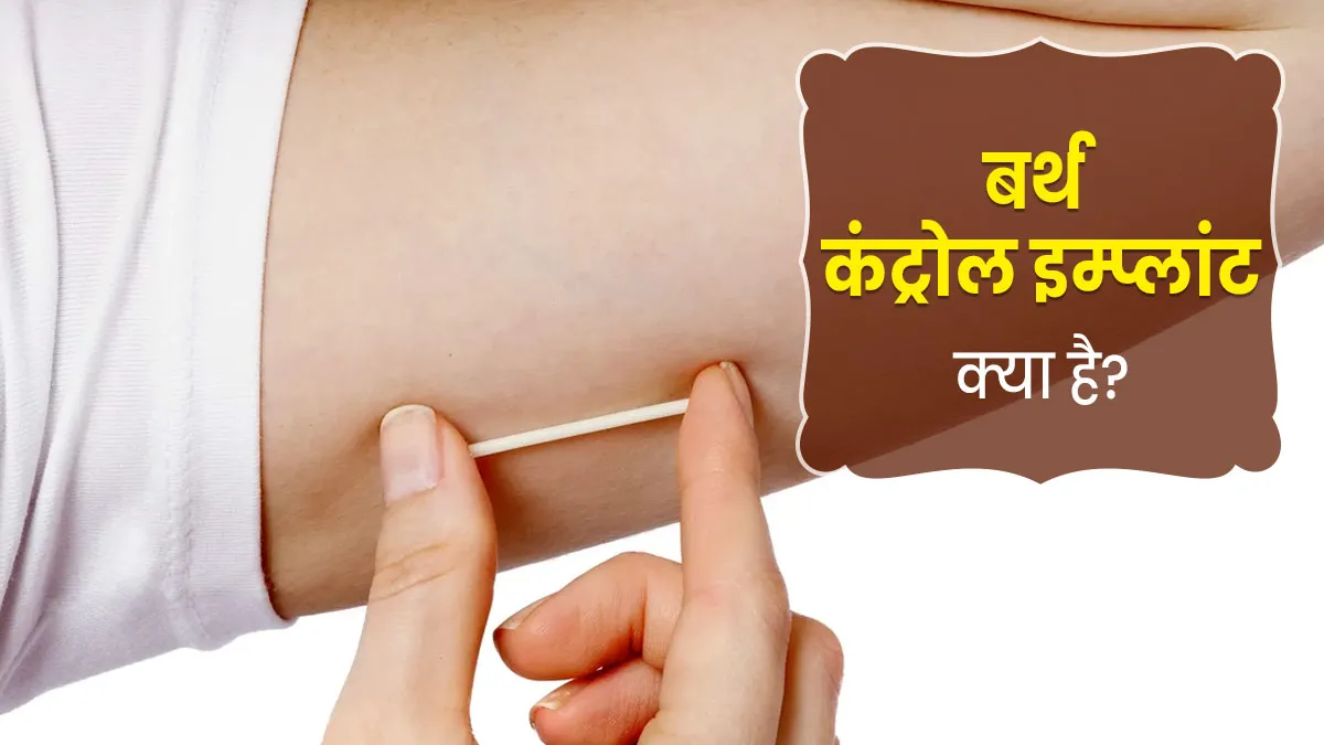 अनचाही प्रेग्नेंसी को रोक सकता है बर्थ कंट्रोल इम्प्लांट, जानें यह कैसे काम करता है