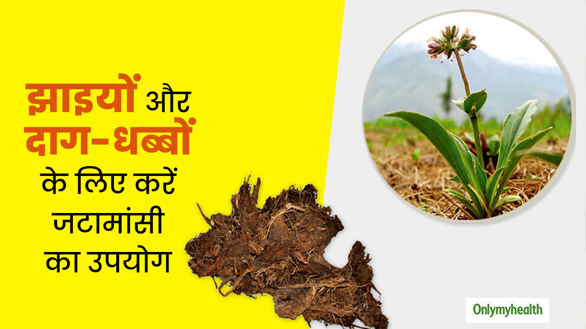 जटामांसी से पाएं झाइयों और दाग-धब्बों से छुटकारा, जानें उपयोग और फायदे