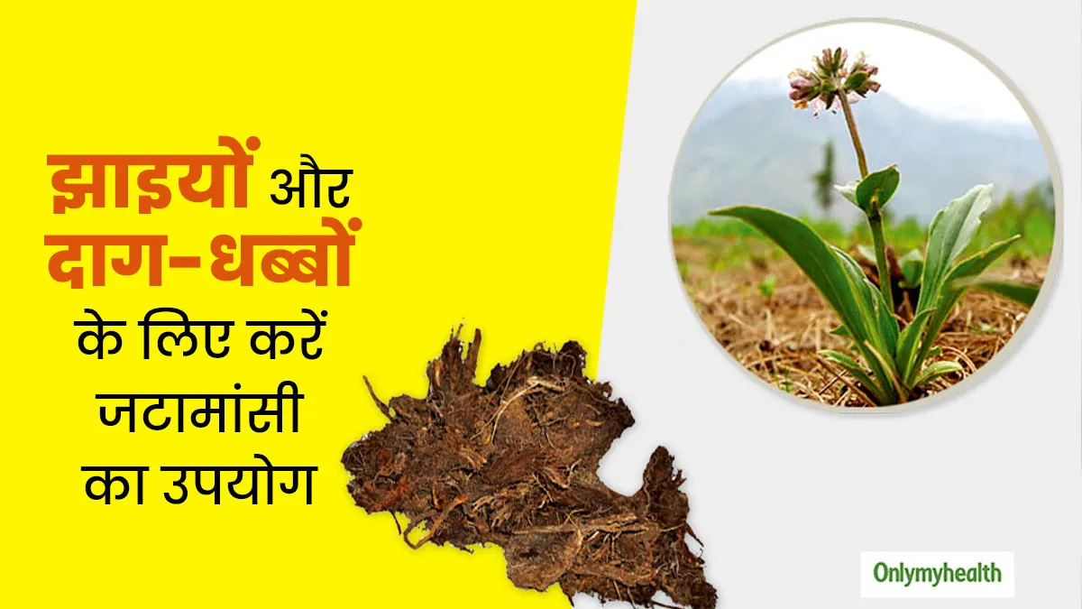 जटामांसी से पाएं झाइयों और दाग-धब्बों से छुटकारा, जानें उपयोग और फायदे