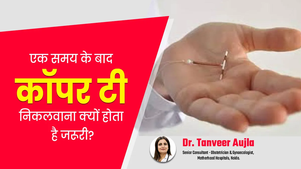 एक समय के बाद कॉपर टी निकलवाना क्यों होता है जरूरी? जानें गायनाकॉलॉजिस्ट से