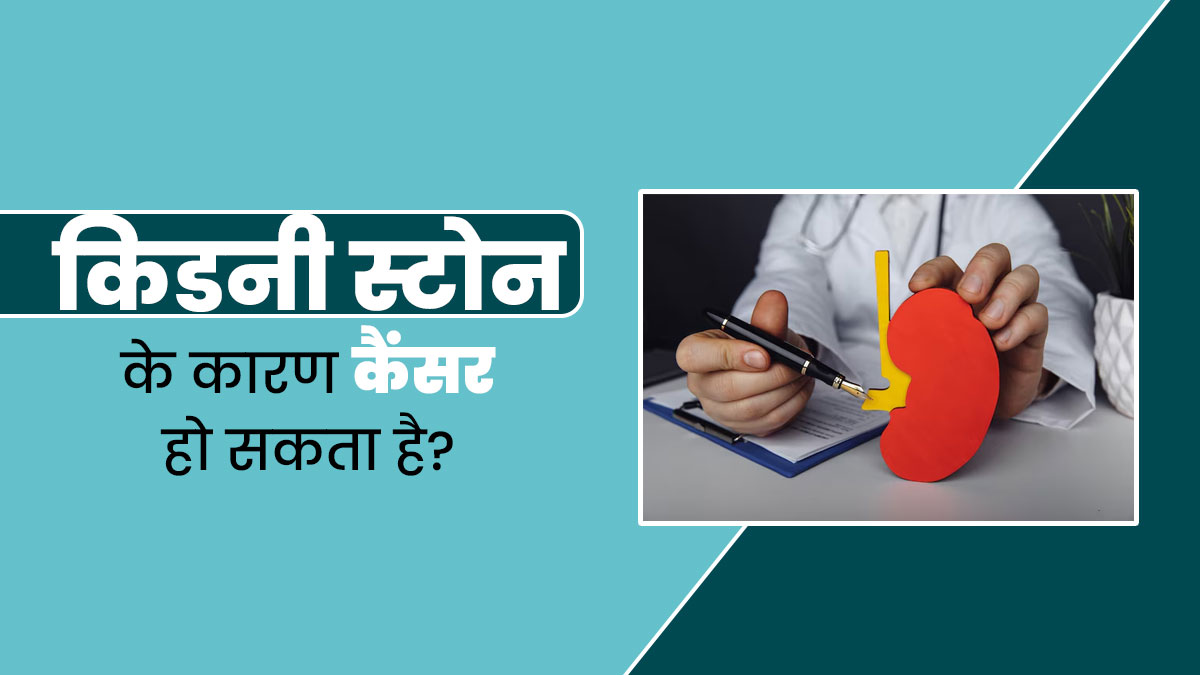 क्या किडनी की पथरी की वजह से कैंसर हो सकता है? जानें डॉक्टर से