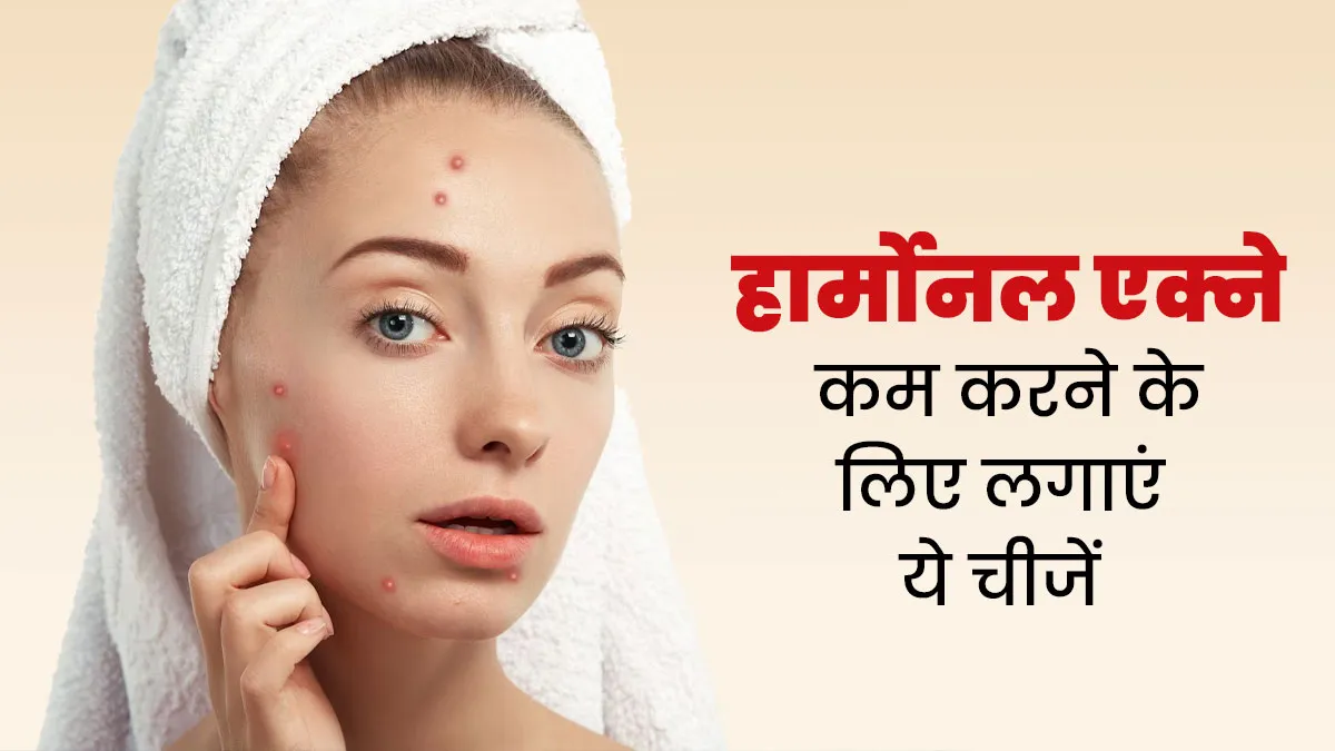 हार्मोनल एक्ने कम करने के लिए चेहरे पर लगाएं ये 5 चीजें, जल्द दिखेगा असर