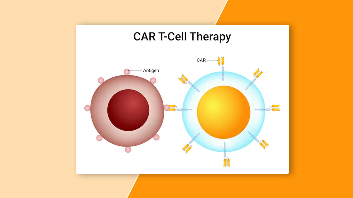 t-cell-therapy-cancer
