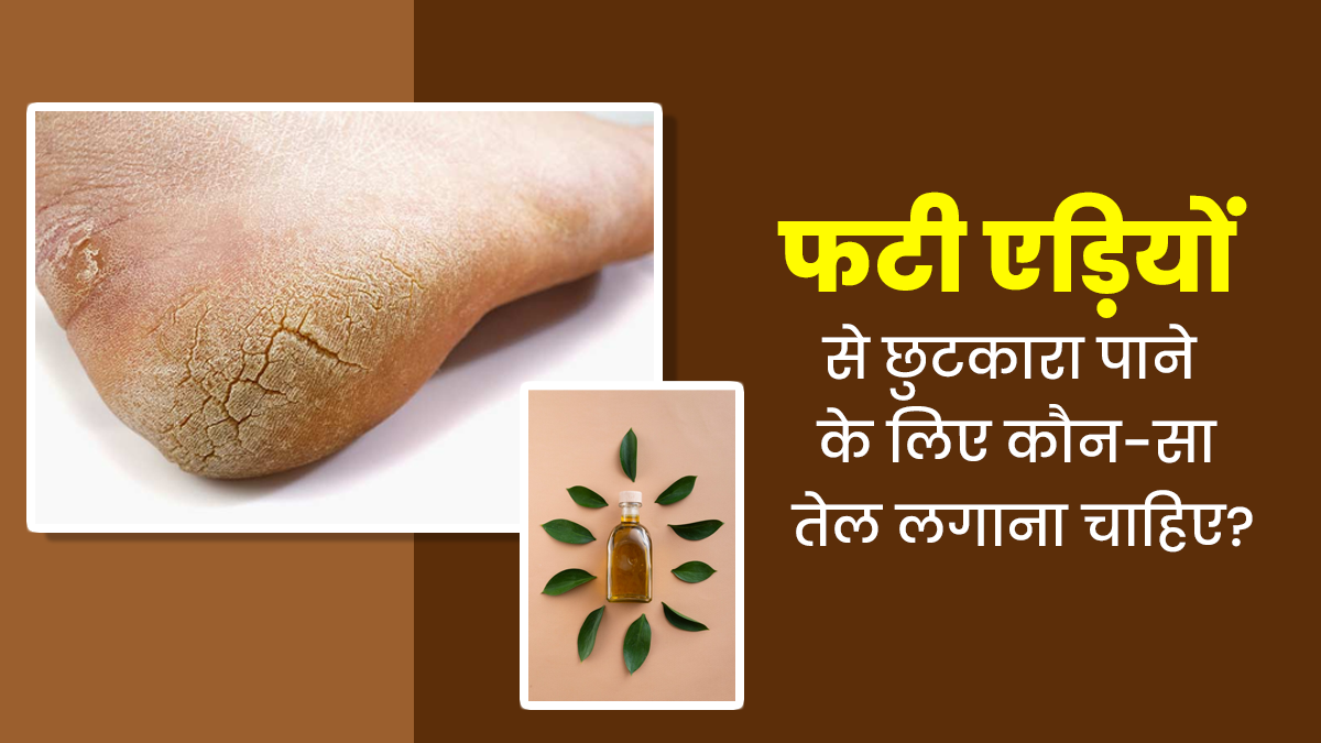 फटी एड़ियों से छुटकारा पाने के लिए कौन-सा तेल लगाना चाहिए? एक्सपर्ट से जानें