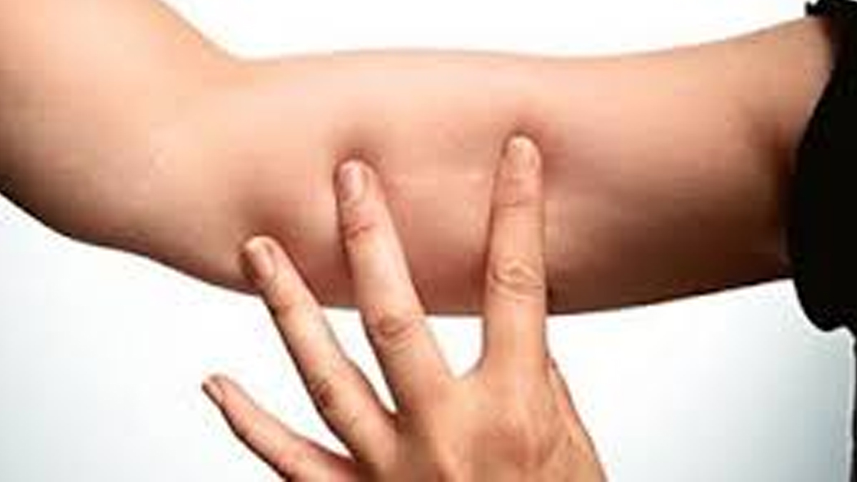 can-Birth-control-implant-cause-cancer-insid222