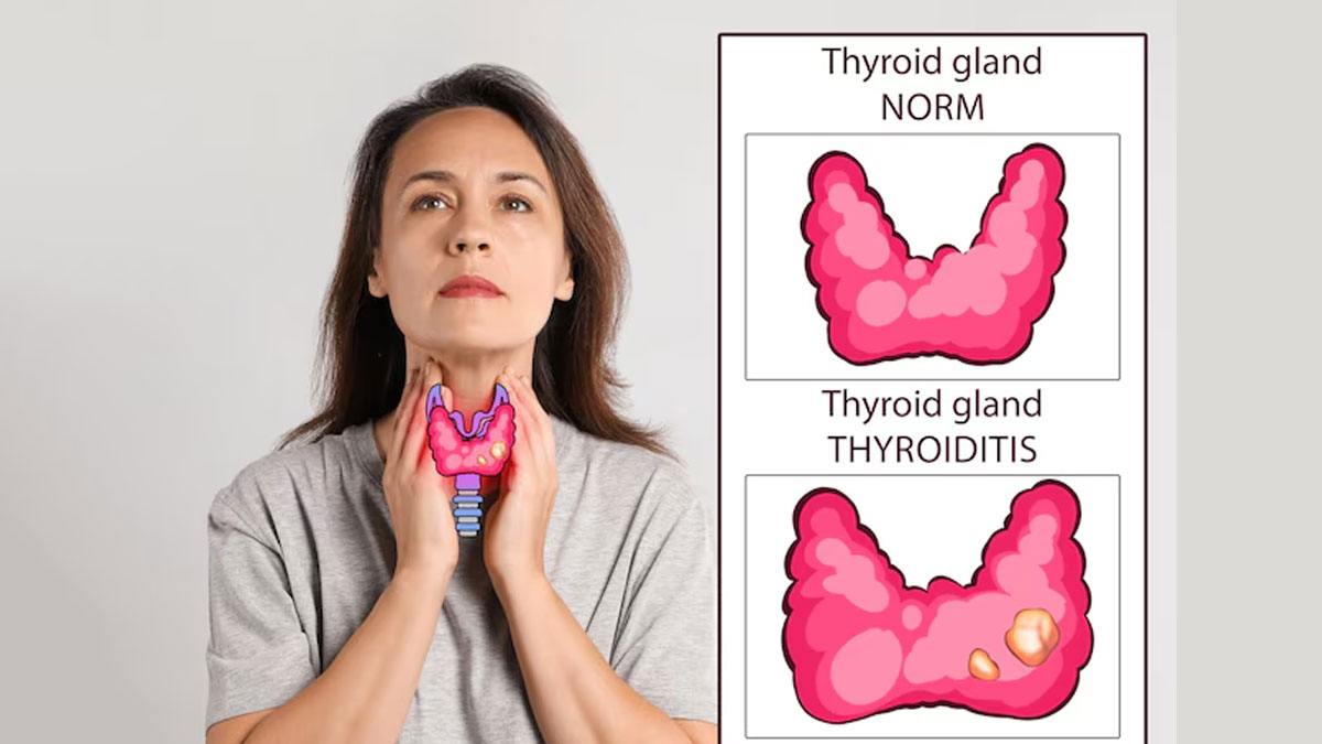 what causes thyroid problem after pregnancy doctor explains
