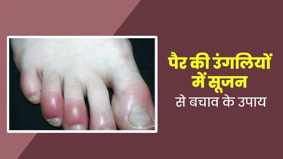 सर्दियों में ठंड के कारण पैर की उंगलियों में हो जाती है सूजन, तो बचाव के लिए अपनाएं ये टिप्स