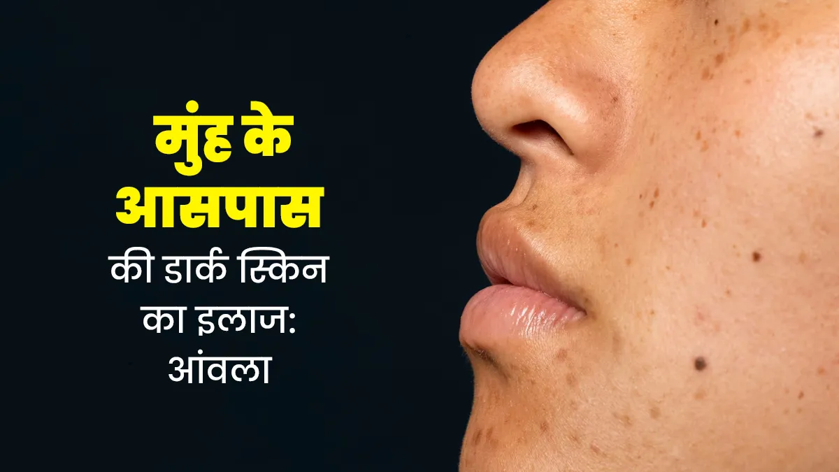 मुंह के आसपास की डार्क स्किन से छुटकारा पाने के लिए ऐसे करें आंवला का इस्तेमाल, म‍िलेगी निखरी त्वचा