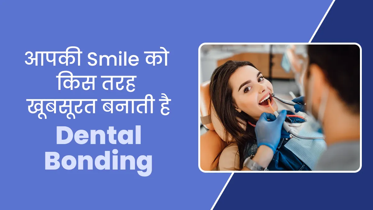 आपकी Smile को खूबसूरत बनाती है Dental Bonding, जानें इसके फायदे