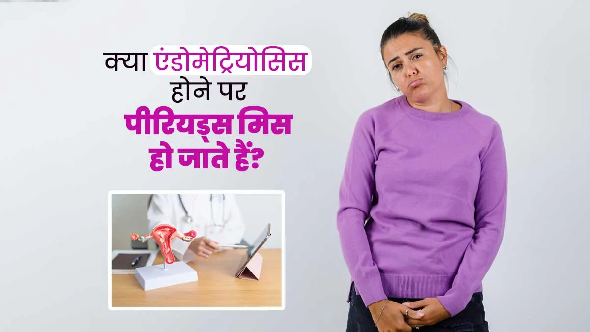 क्या एंडोमेट्रियोसिस के कारण पीरियड्स मिस हो सकते हैं? जानें डॉक्टर से