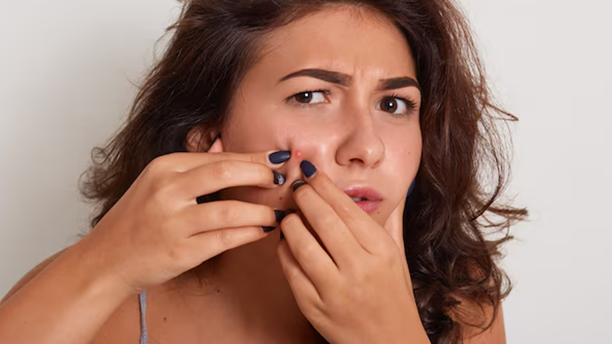 Prevention-tips-for-open-pores-on-face-in