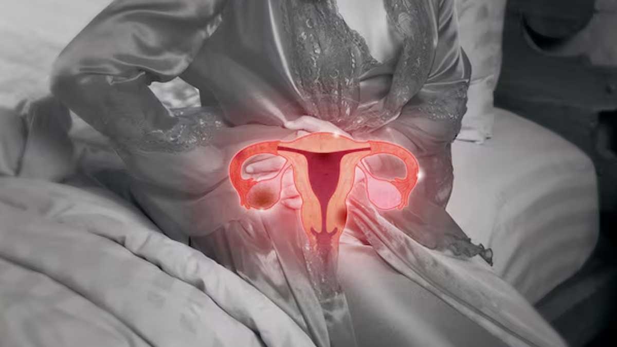 Complications Of Bartholin Cyst In Women in Hindi complications-of-bartholin-cyst-in-women-in