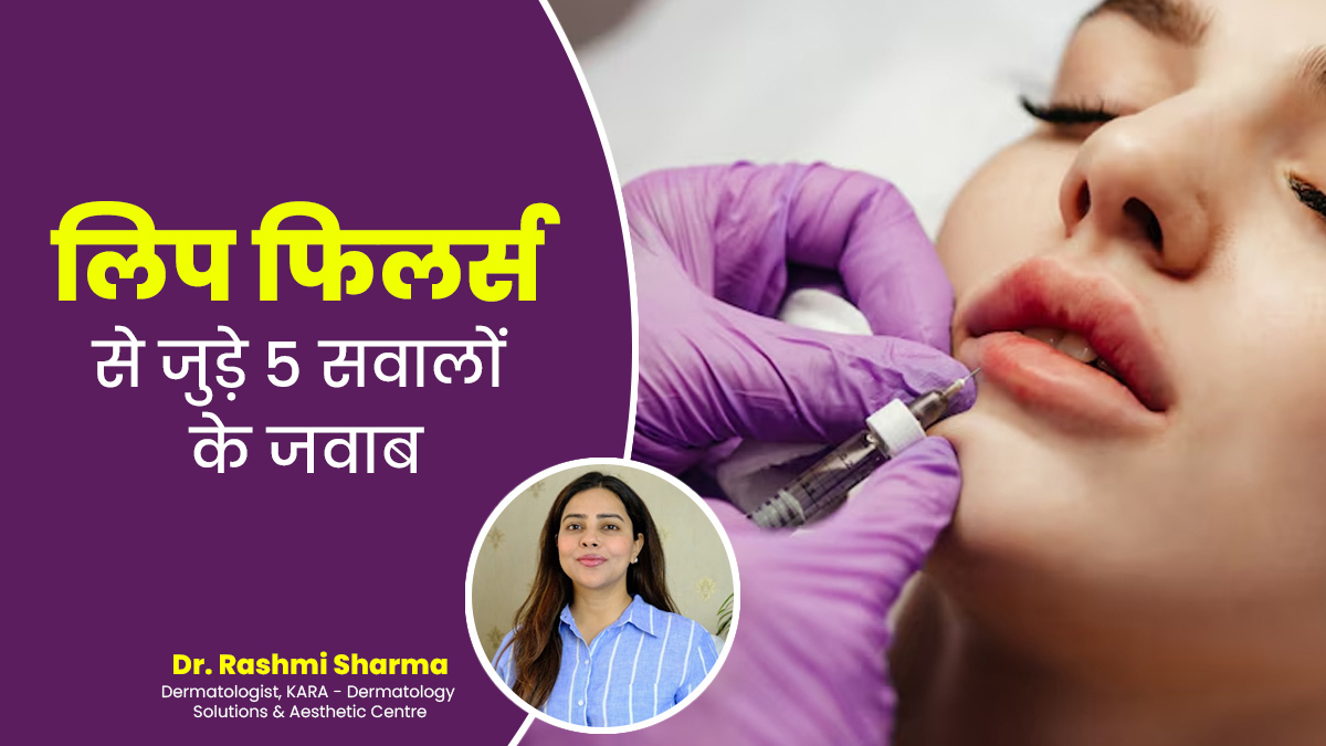 लिप फिलर्स कितने समय तक टिकते हैं? डॉक्टर से जानें Lip Fillers से जुड़े ऐसे 5 सवालों के जवाब