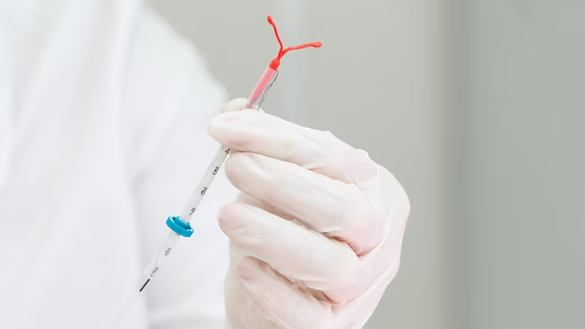 कॉपर-टी क्या है, यह डिवाइस कैसे काम करता है? जानें गायनाकॉलॉजिस्ट से | What is use of Copper T and how it is work in hindi Copper-t-inside