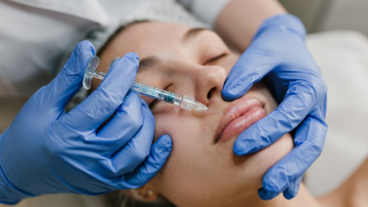 How Long Do Lip Fillers Last