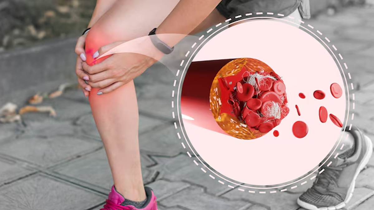 can you eat nuts if you have high uric acid 02