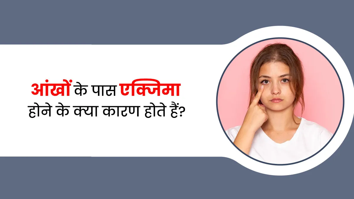 आंखों के पास एक्जिमा होने के क्या कारण होते हैं? जानें इसके इलाज का तरीका