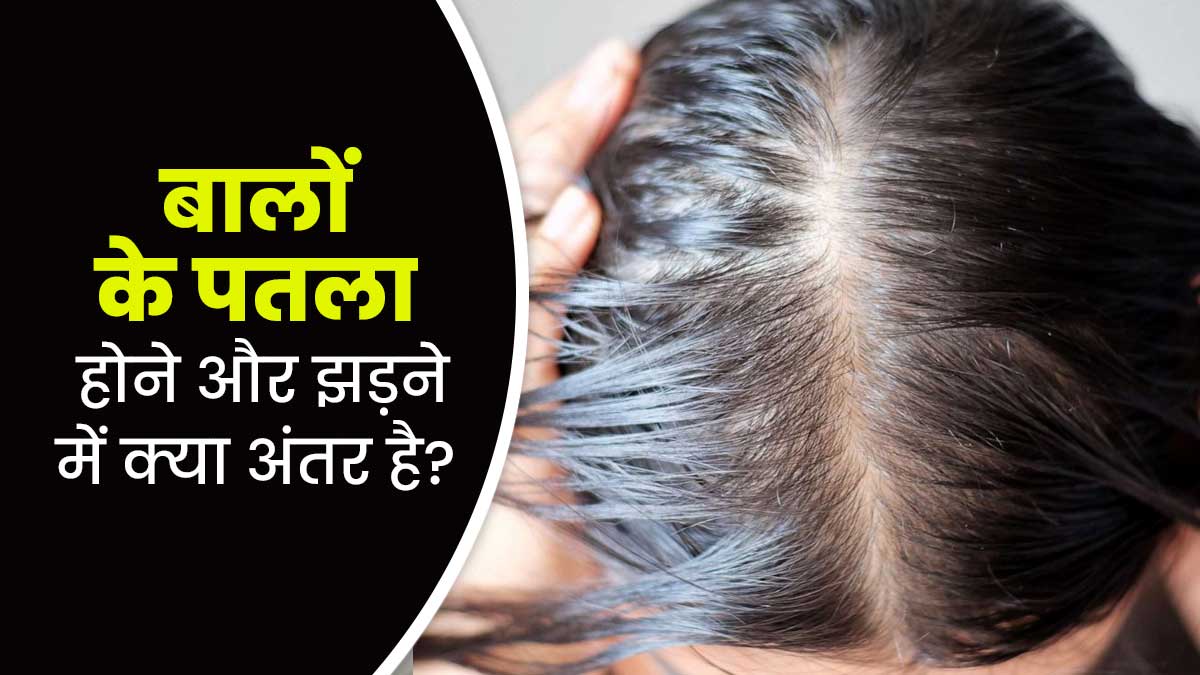 बालों के पतले होने और झड़ने में होता है अंतर, कारण और लक्षण से समझें फर्क