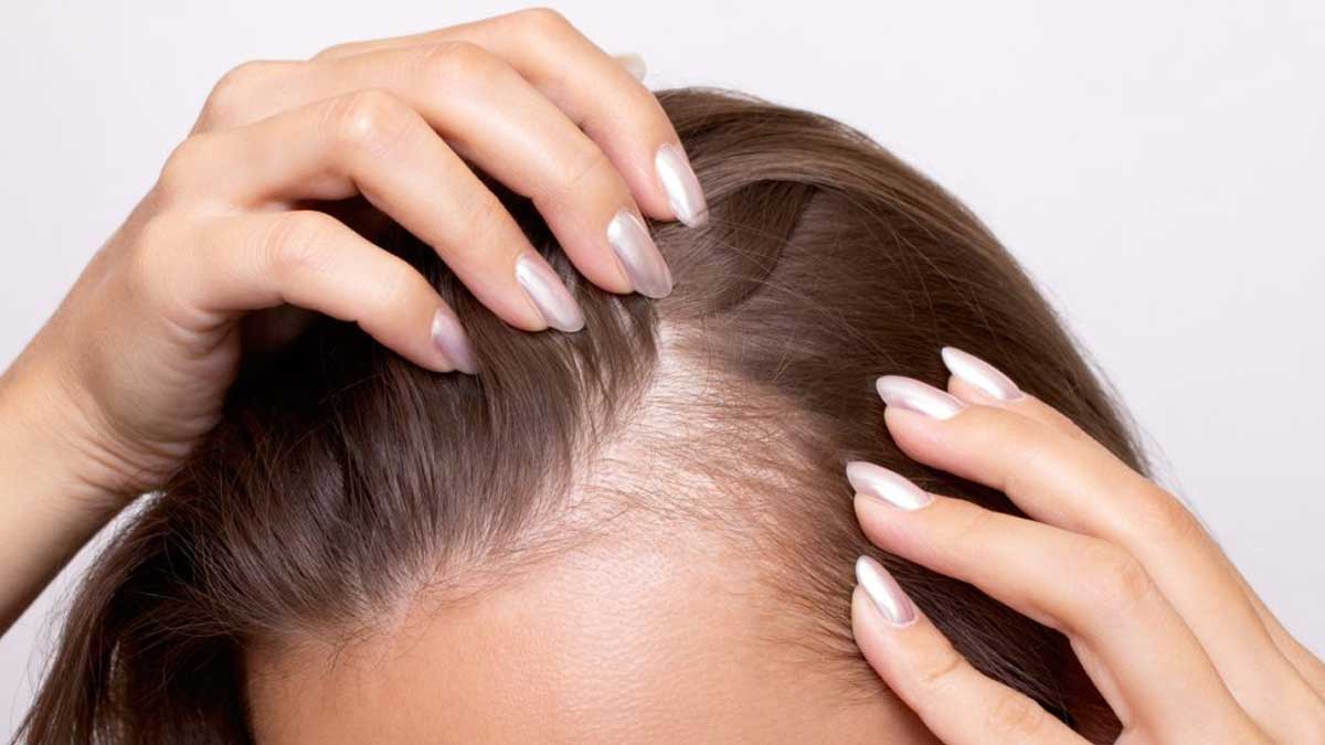 hair-fall-and-hair-thinning