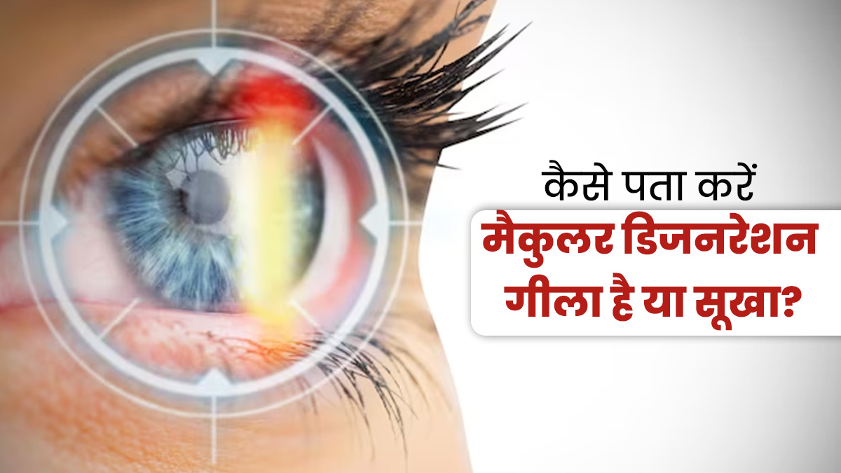 आंखों में होने वाला मैक्युलर डिजेनेरेशन Dry है या Wet, डॉक्टर से जानें कैसे पहचानें