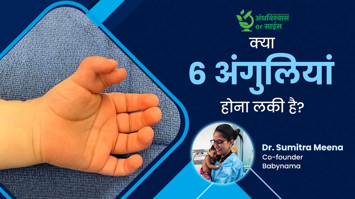 क्या सच में सौभाग्यशाली होते हैं 6 उंगली के साथ पैदा हुए बच्चे? जानें क्या कहते हैं डॉक्टर