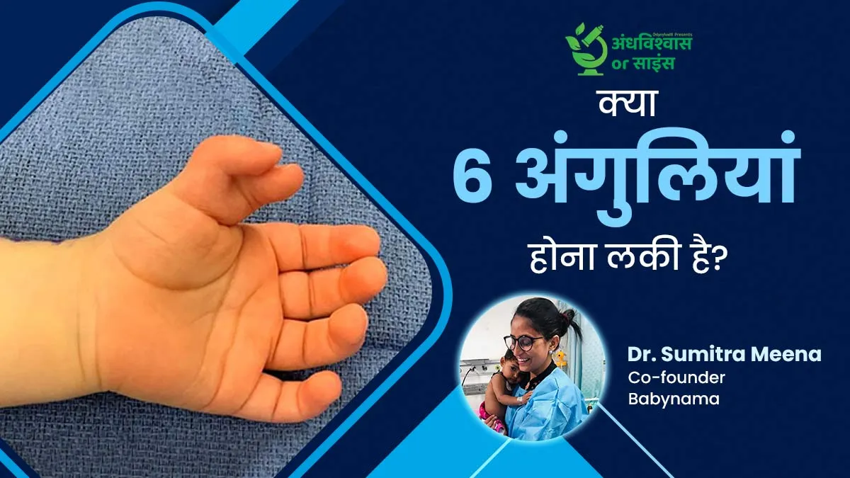 क्या सच में सौभाग्यशाली होते हैं 6 उंगली के साथ पैदा हुए बच्चे? जानें क्या कहते हैं डॉक्टर