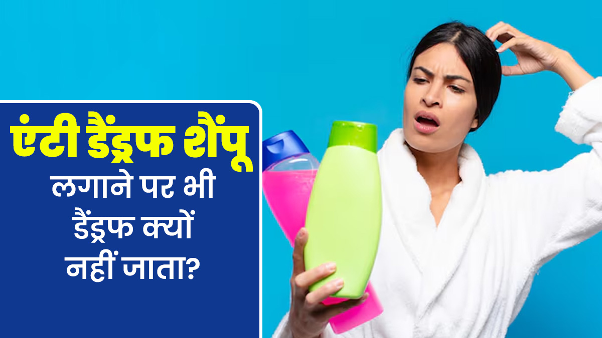 एंटी डैंड्रफ शैंपू लगाने पर भी क्यों नहीं जाता डैंड्रफ? डॉक्टर से जानें