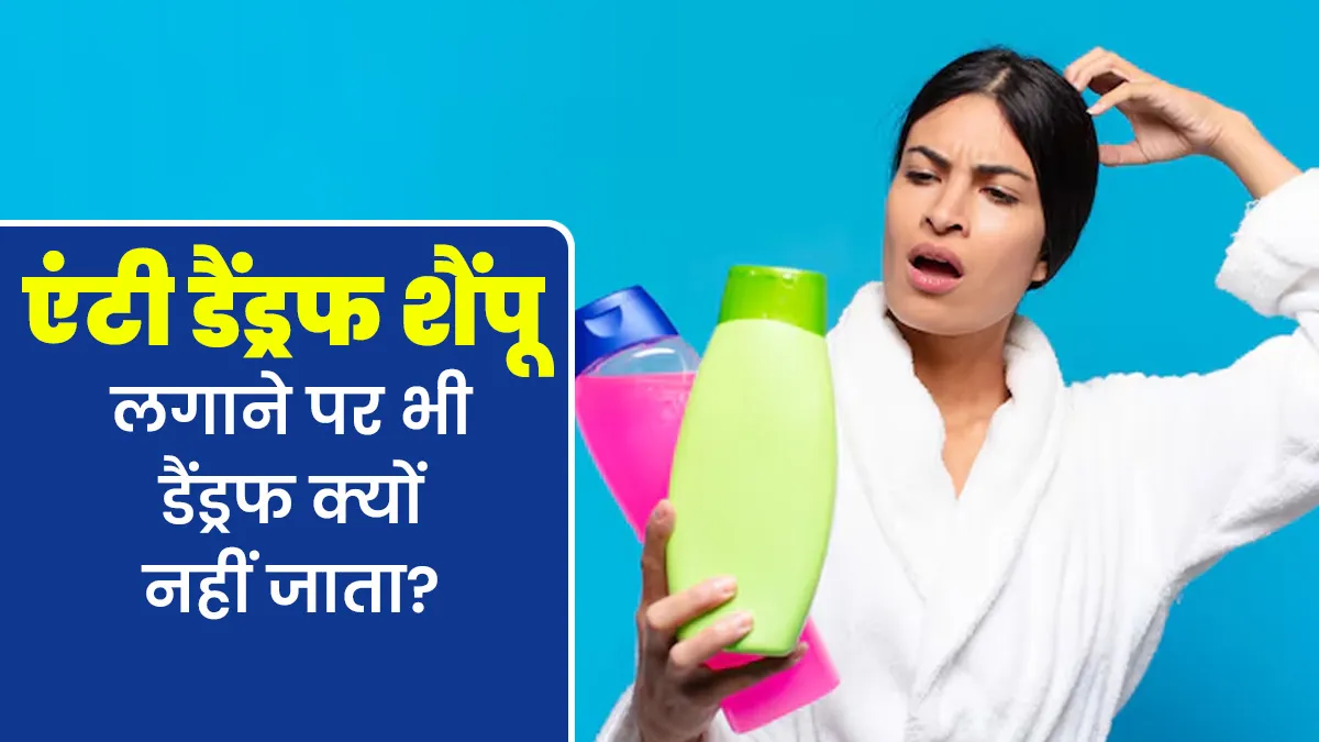एंटी डैंड्रफ शैंपू लगाने पर भी क्यों नहीं जाता डैंड्रफ? डॉक्टर से जानें