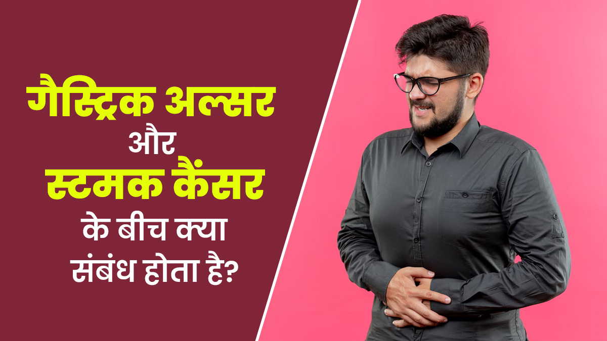 गैस्ट्रिक अल्सर और पेट के कैंसर के बीच क्या कनेक्शन है? डॉक्टर से जानें