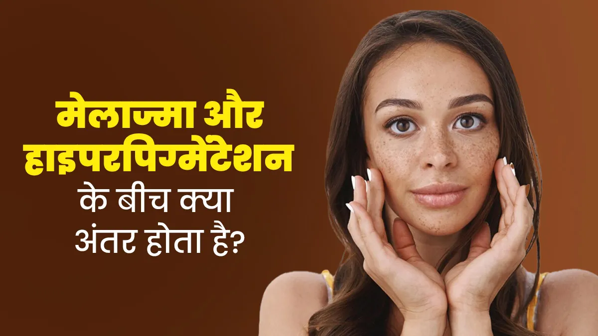 मेलाज्मा और हाइपरपिग्मेंटेशन के बीच क्या अंतर होता है? डॉक्टर से जानें