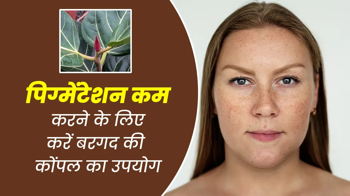 पिग्मेंटेशन कम करने के लिए करें वटांकुर (बरगद की कोंपल) का उपयोग, जानें तरीका