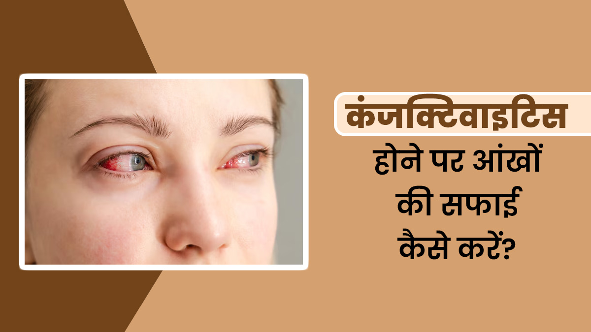 कंजक्टिवाइटिस होने पर आंखों की सफाई कैसे करें? जानें डॉक्टर से