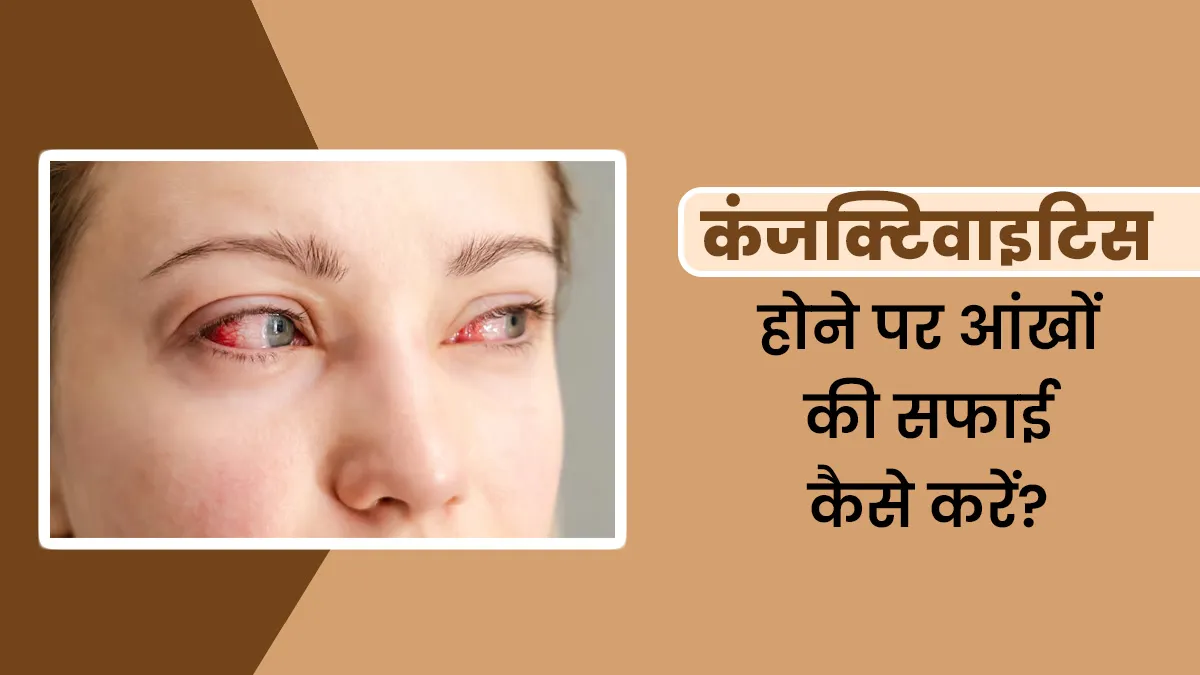 कंजक्टिवाइटिस होने पर आंखों की सफाई कैसे करें? जानें डॉक्टर से