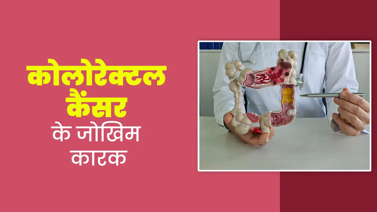 Colorectal Cancer: कोलोरेक्टल कैंसर के जोखिम को बढ़ा सकते हैं ये 5 कारक, डॉक्टर से जानें बचाव के उपाय