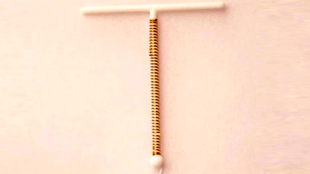 How-Does-an-Intrauterine-Device-Affect-Your-Period-inside1