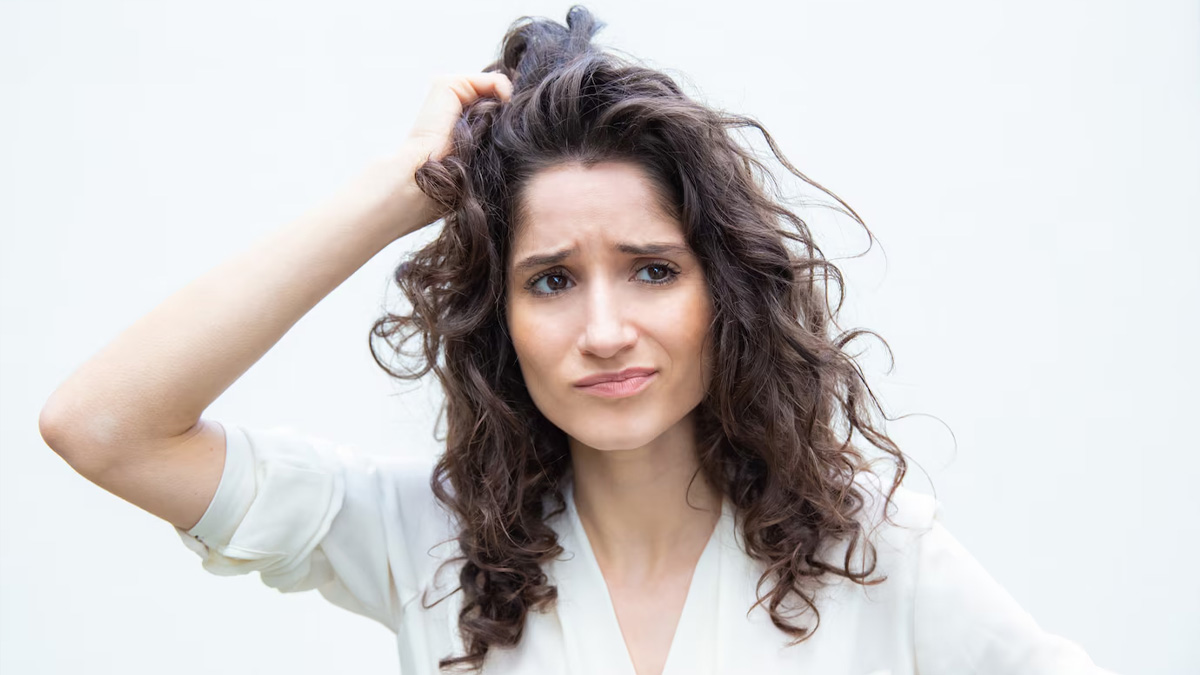 can dandruff cause hair thinning01 (1)