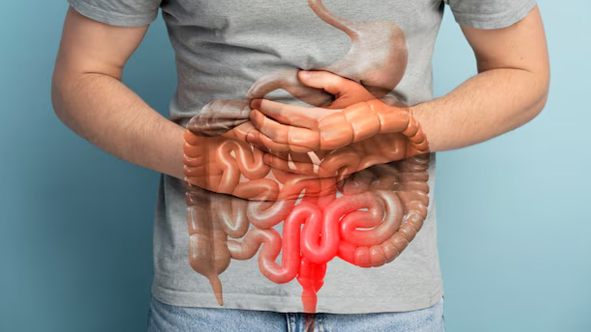 connection-between-gastric-ulcers-and-stomach-cancer-risk-in