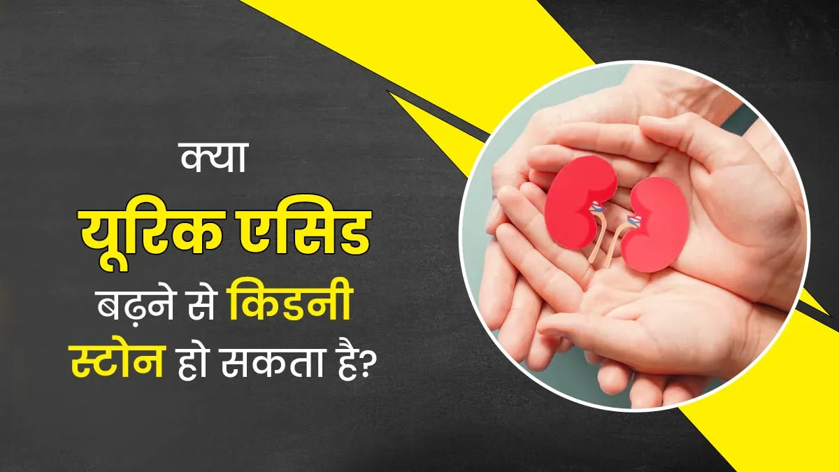 क्या यूरिक एसिड बढ़ने से किडनी स्टोन हो सकता है? डॉक्टर से जानें