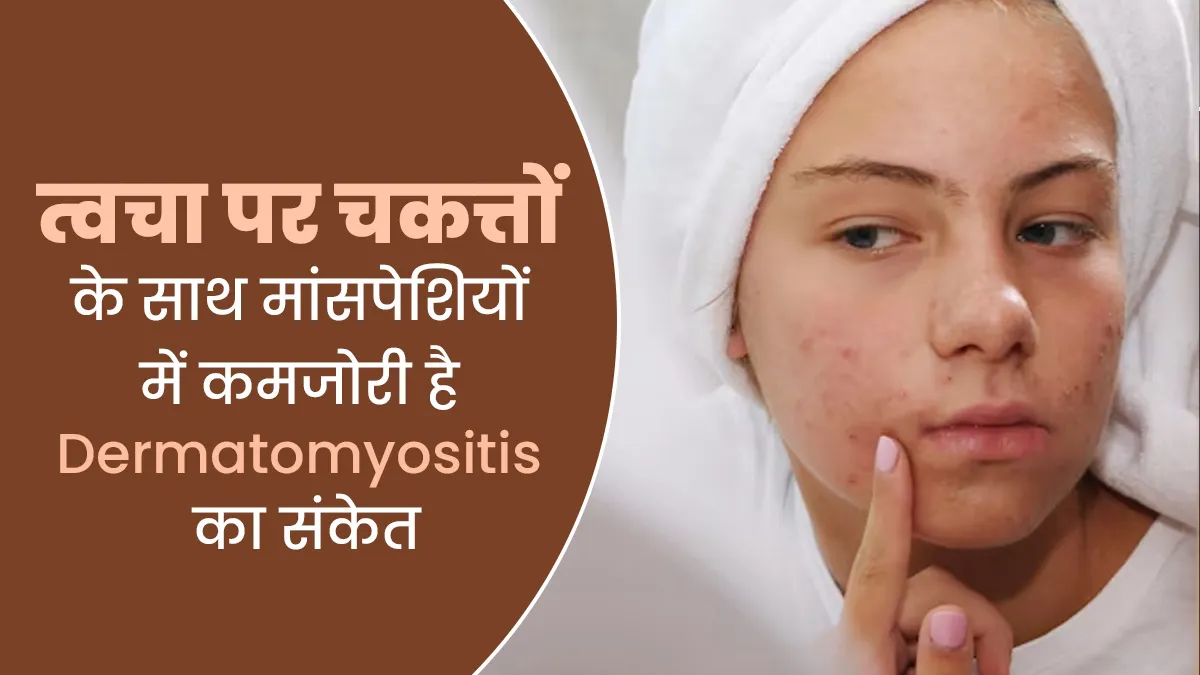त्वचा पर चकत्तों के साथ मांसपेशियों में कमजोरी है डर्मेटोमायोसाइटिस का संकेत, जानें इसके कारण और लक्षण