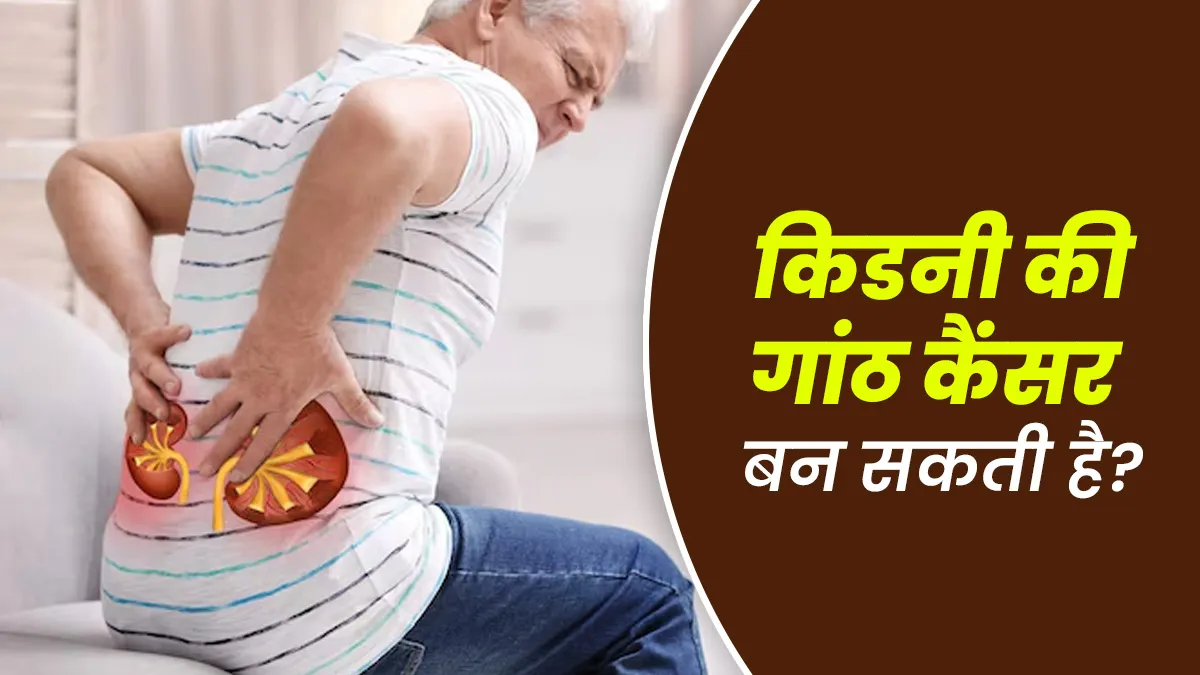 क्‍या सच में किडनी की गांठ धीरे-धीरे कैंसर बन जाती है? डॉक्‍टर से जानें