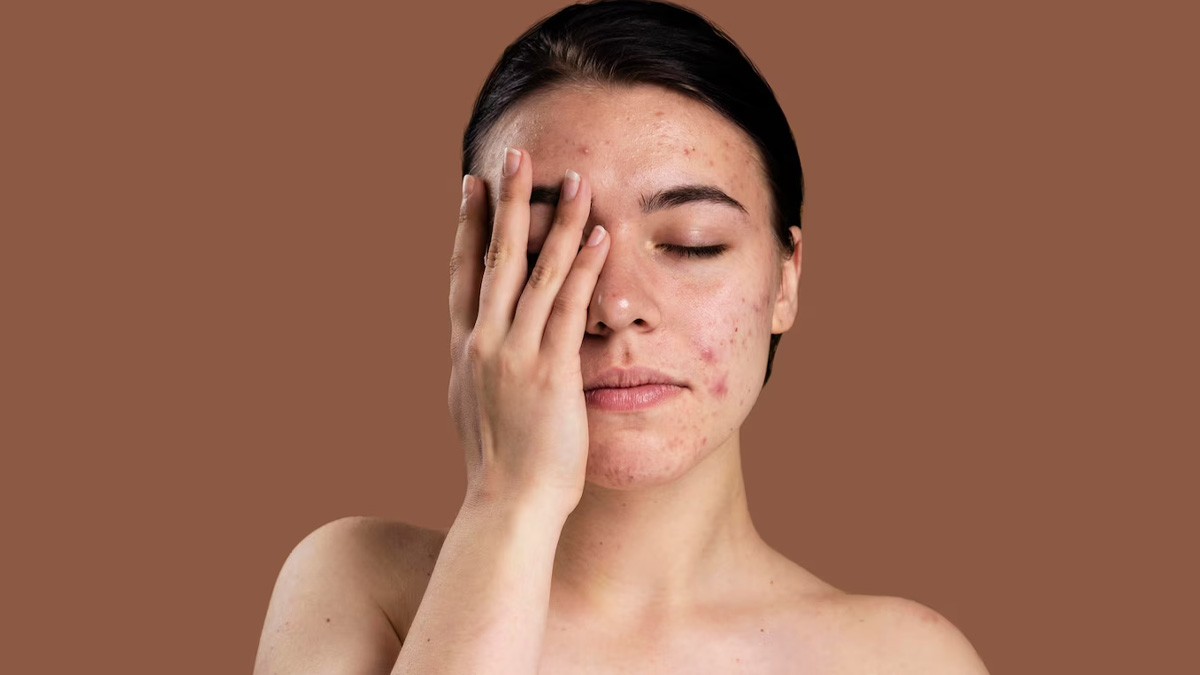 dermatomyositis-causes-symptoms-in